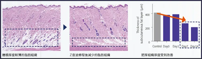 脂肪組織厚度體積減少