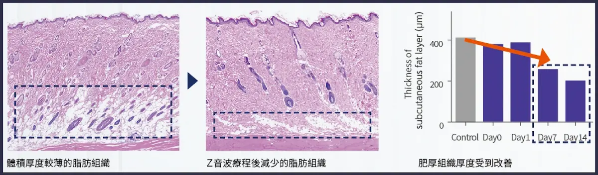 脂肪組織厚度體積減少