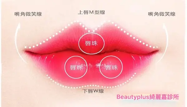 微笑唇手術-完美唇型比例