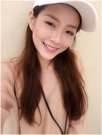 消除眼袋報導
