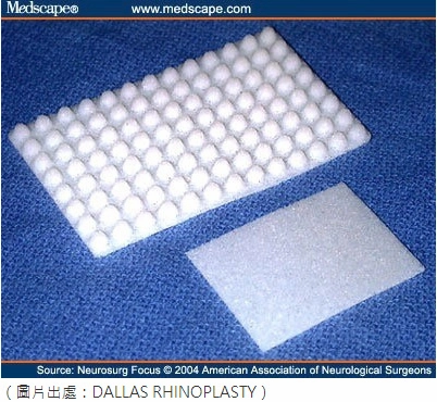 結構性隆鼻報導