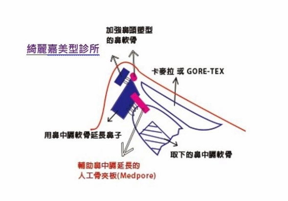手術方式