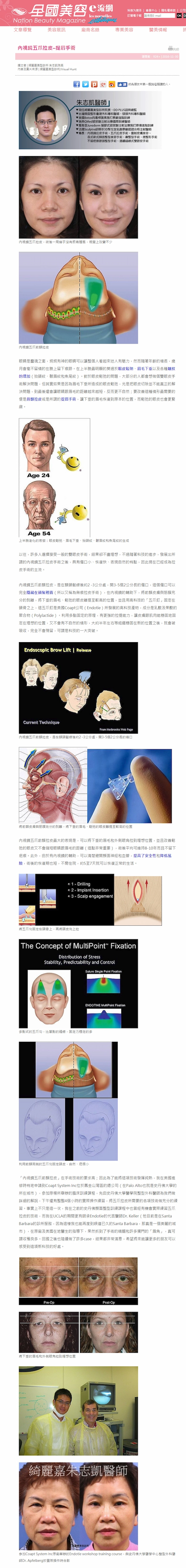 提眉手術報導