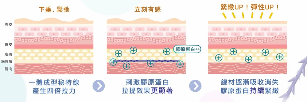 MINT埋線 MINT埋線