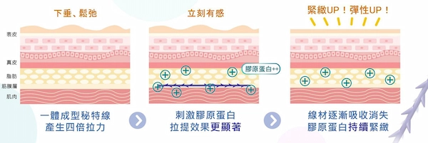 MINT埋線 MINT埋線