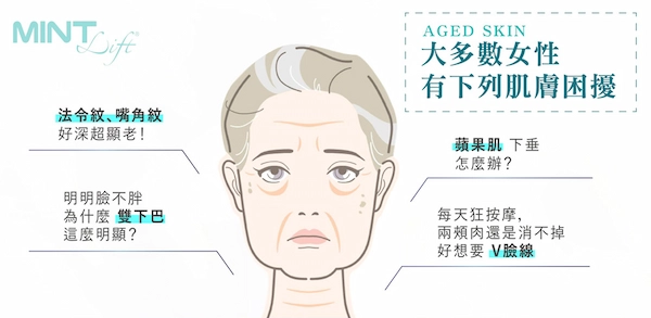 MINT埋線 MINT埋線