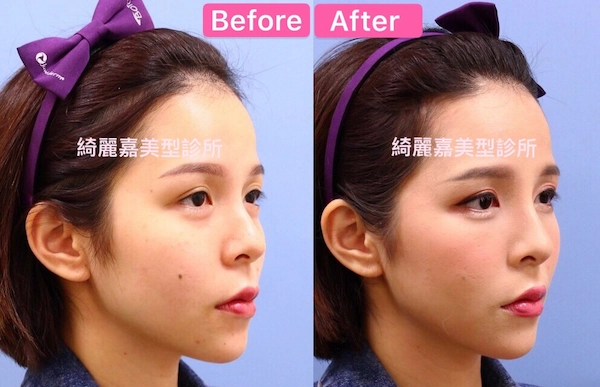 陳香菱推薦3