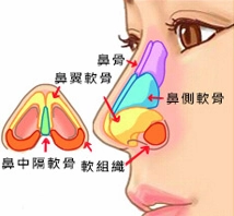 軟骨鼻整形 軟骨鼻整形