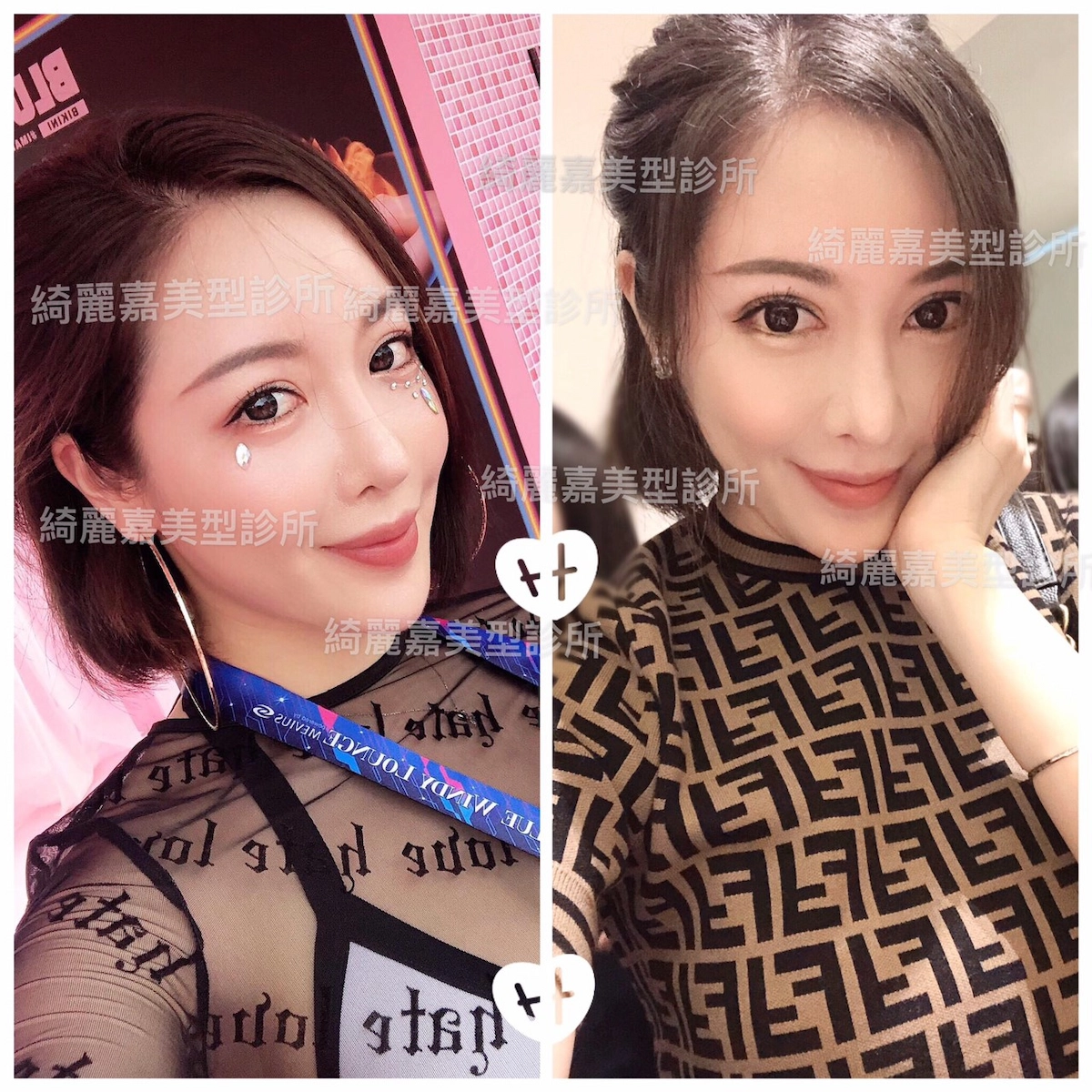 開眼尾及下置