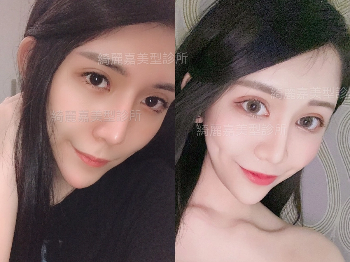 開眼尾及下置