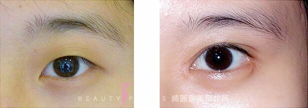 開眼尾及下置