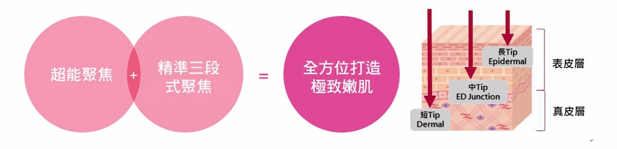 PicoLO柔皮秒 PicoLO柔皮秒