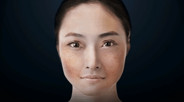 柔皮秒 柔皮秒