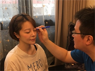 困擾多年的過高雙眼皮