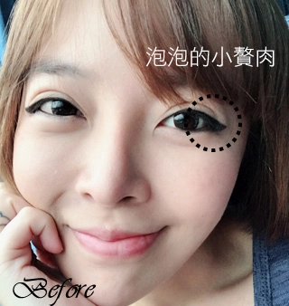 泡泡小贅肉