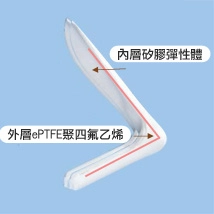 軟骨鼻整形 軟骨鼻整形