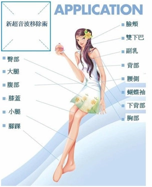 超音波脂肪雕塑