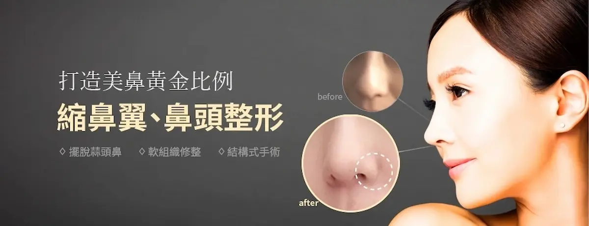 縮鼻翼手術：收窄鼻翼寬度，打造更俐落精緻的鼻型比例