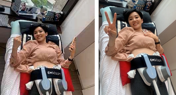 肌動減脂案例 肌動減脂案例