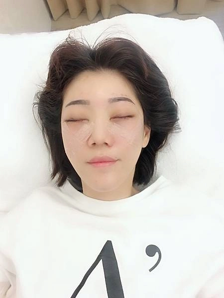 眼袋手術