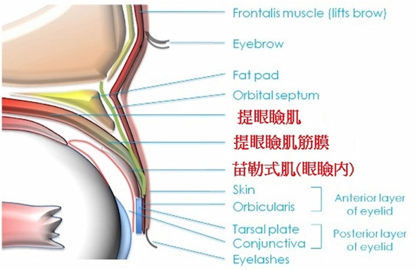 提眼瞼肌位於眼皮的最深處